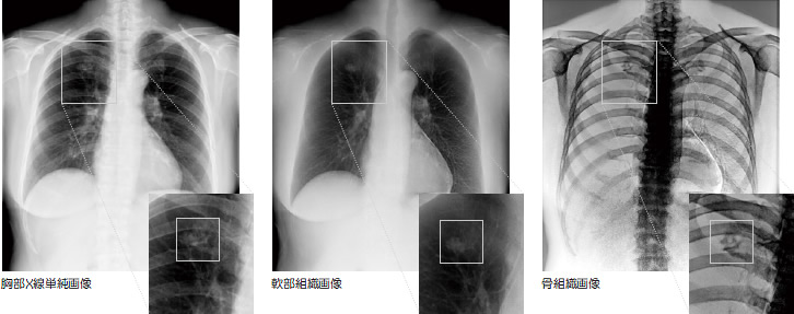 イメージ図　胸部Ｘ線撮影画像
