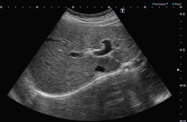 写真 腹部超音波検査