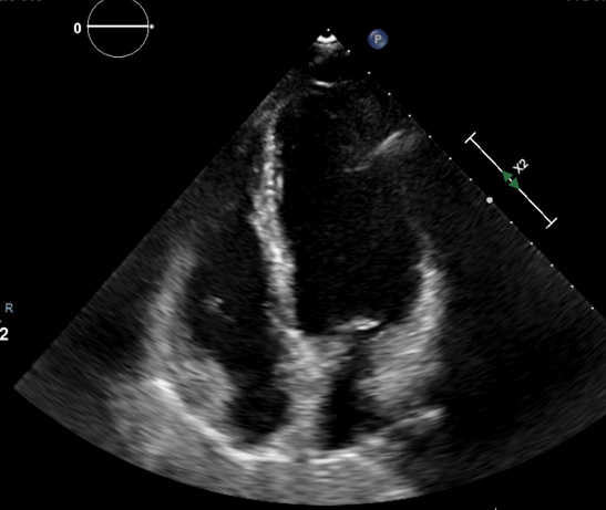 写真 腹部超音波検査