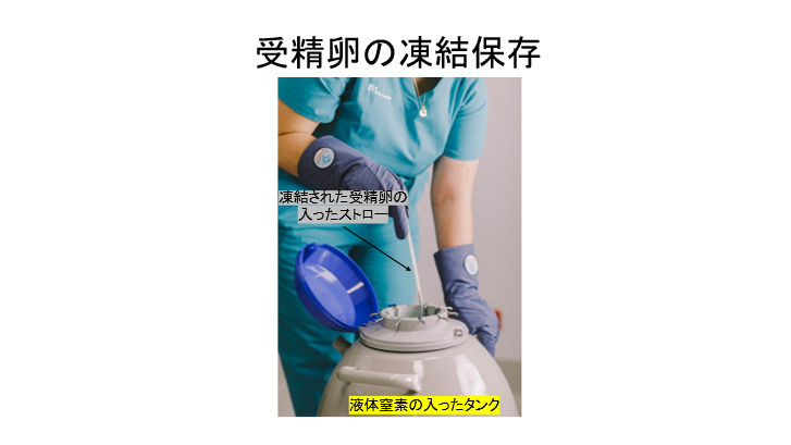 イメージ図 受精卵の凍結保存