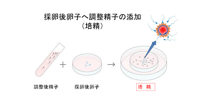 イメージ図 採卵後卵子へ調整精子の添加