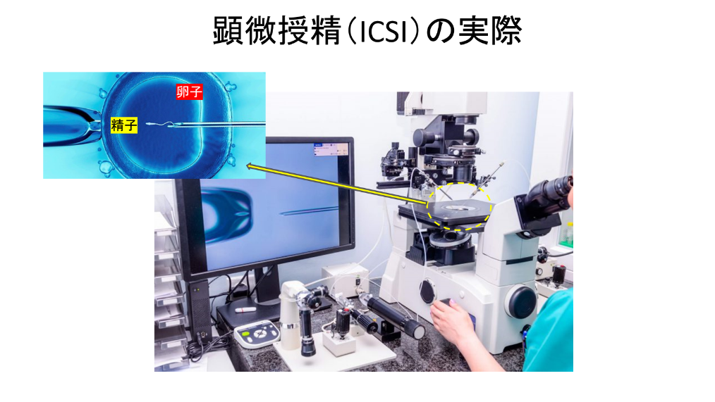 イメージ図 顕微授精の実際