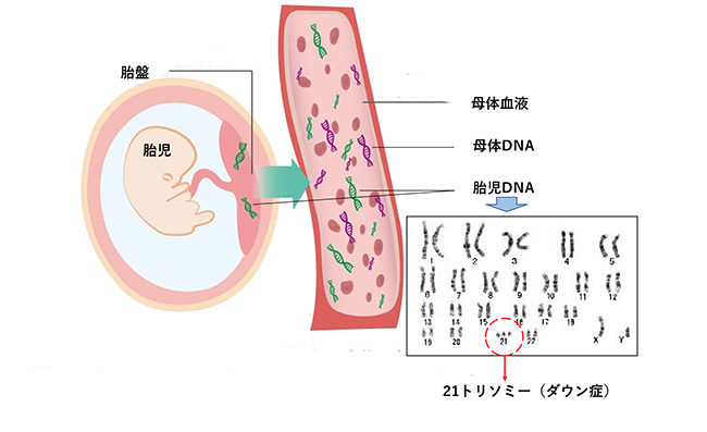 イメージ図 NIPT(新型出生前検査)