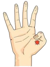 イメージ図 腱鞘炎(ばね指，ドケルバン病)