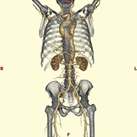 イメージ図 CT画像